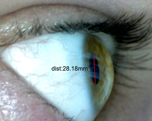 Mesure du diamtre de l'iris avec le logiciel du microscope USB